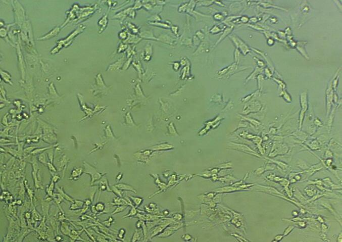 SW1783 Cell|人脑星形胶质瘤细胞