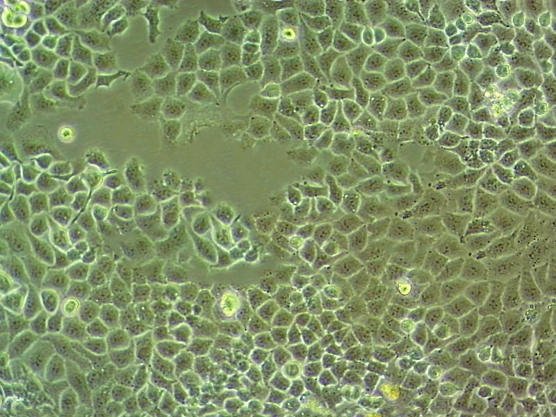 GC9811-P Cell|人胃癌腹膜高转移细胞