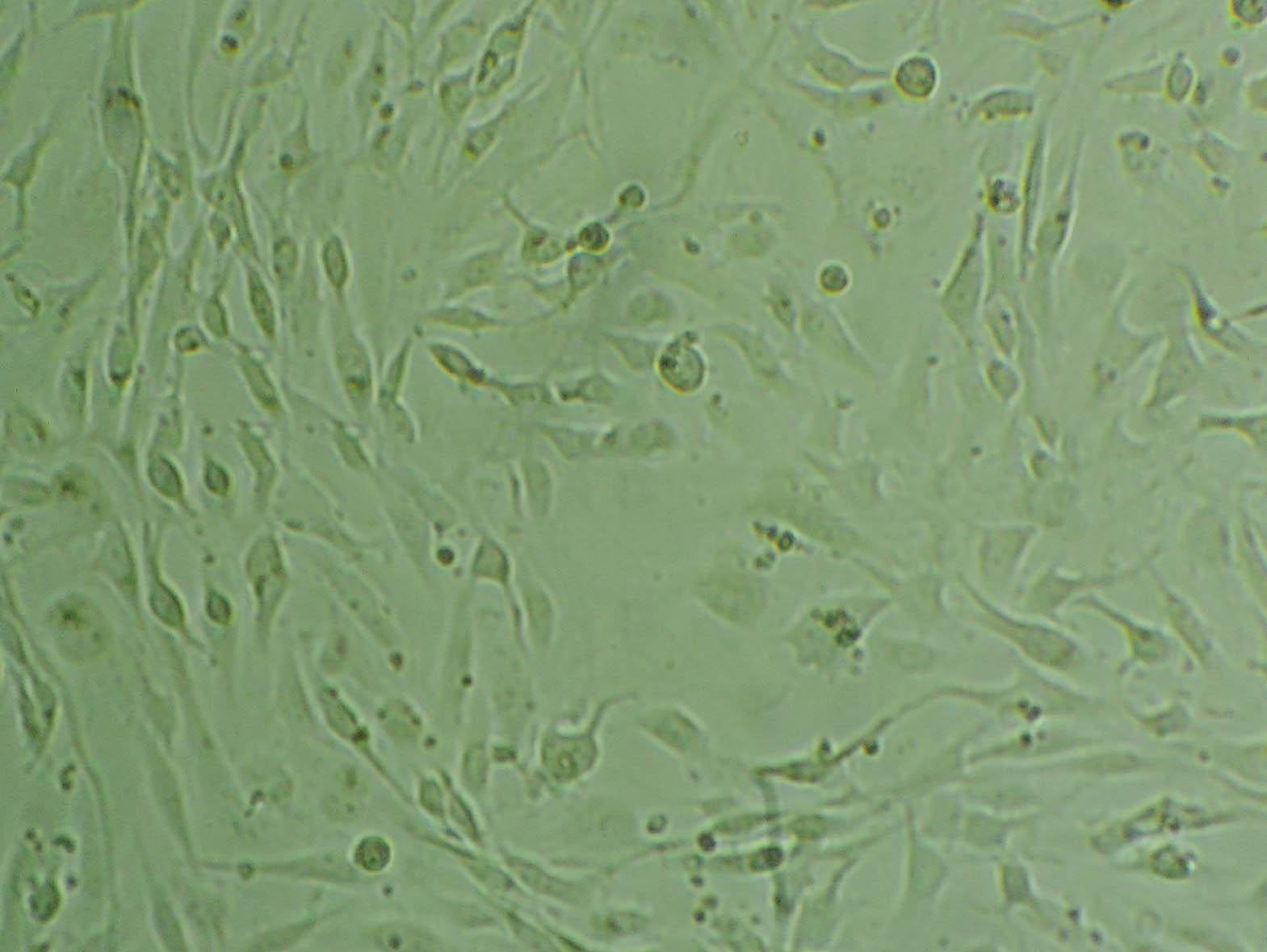 B104 [Rat neuroblastoma] Cell|大鼠神经母细胞瘤细胞