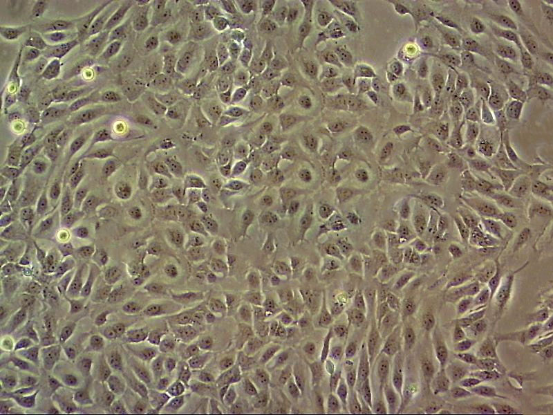 Rh30 Cell|人横纹肌肉瘤细胞