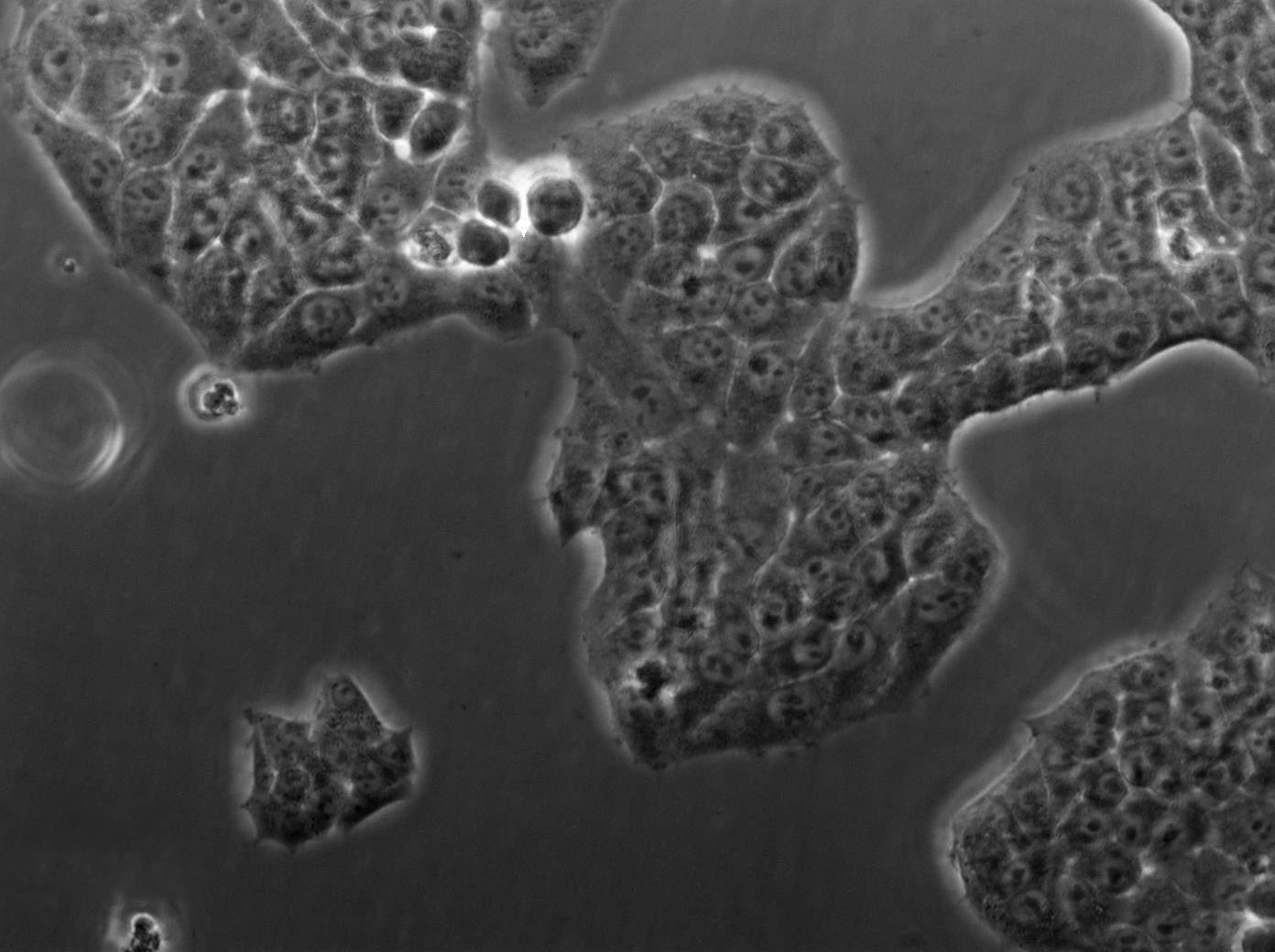 NCI-H719 Cell|人小细胞肺癌细胞