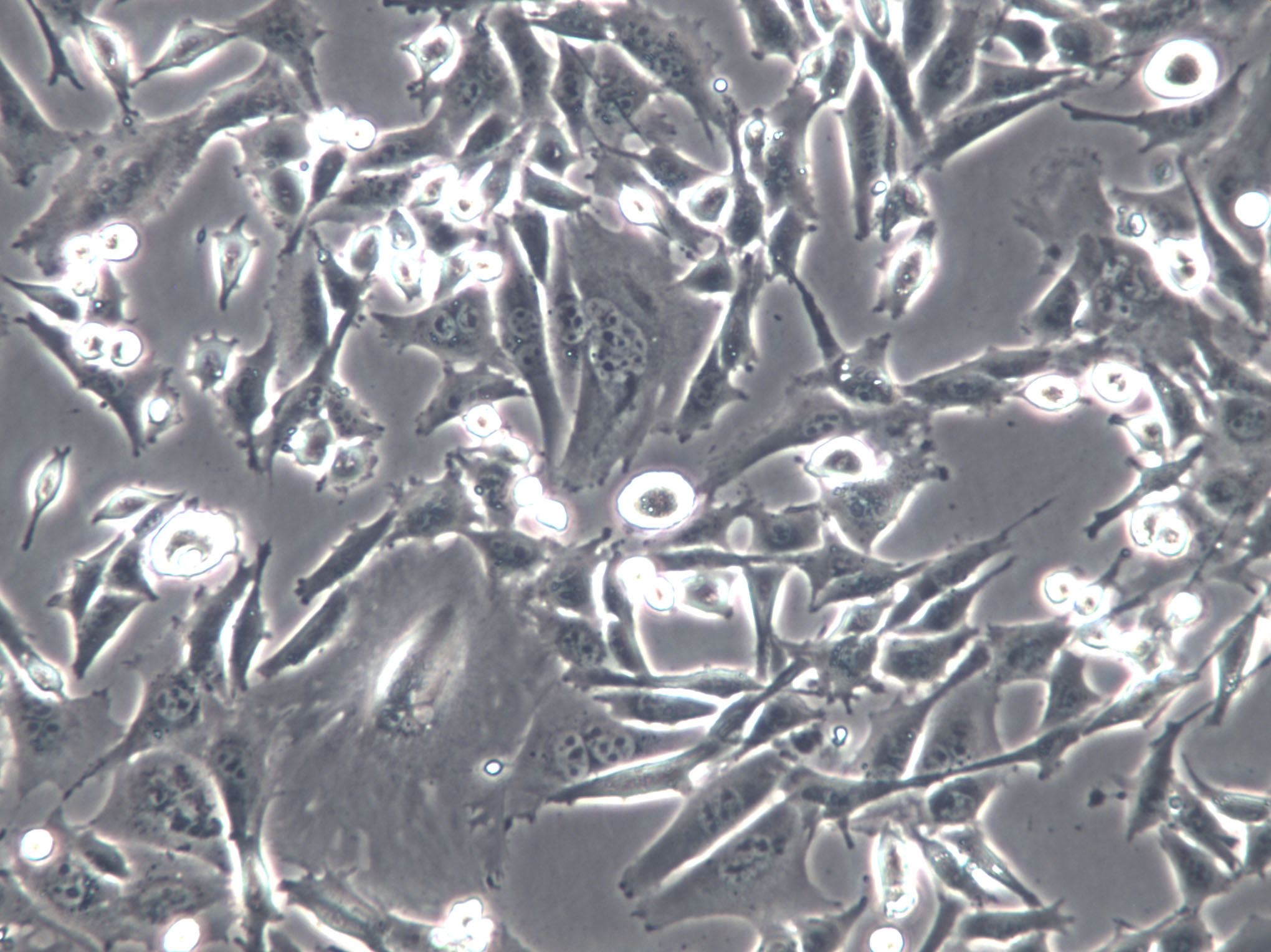 CNE-2Z Cell|人鼻咽癌细胞