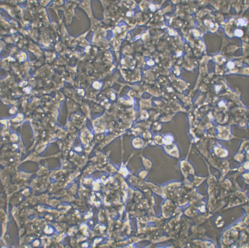 BHP 10-3 Cell|人甲状腺乳头状癌细胞