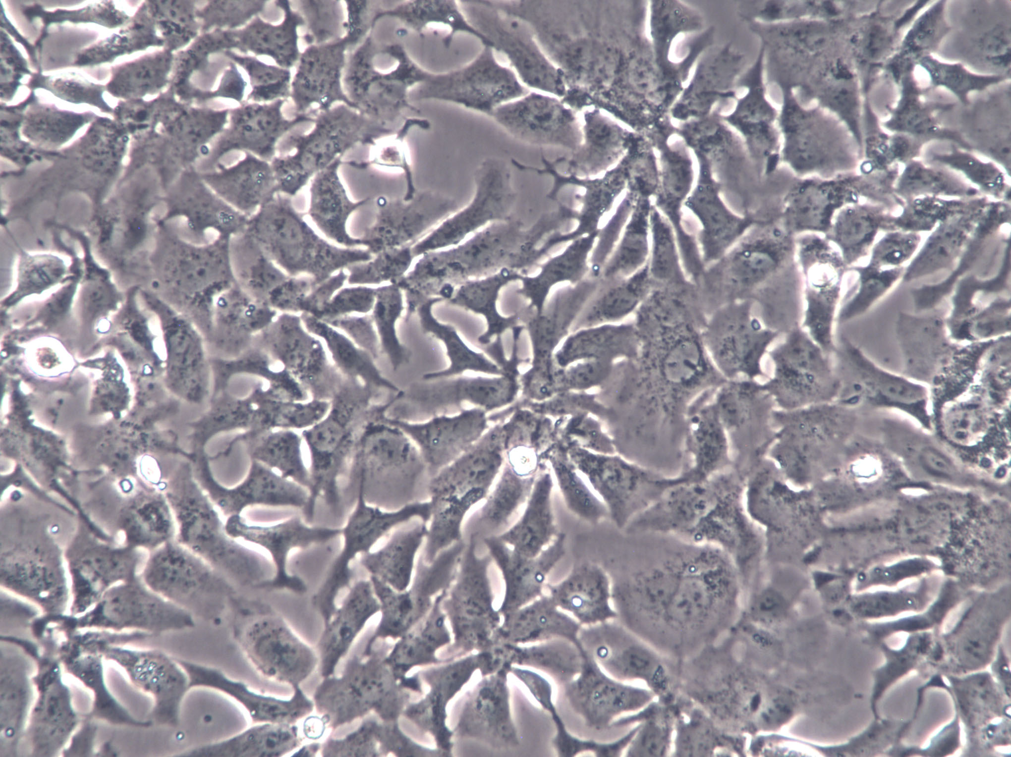 GLC-15 Cell|人肺癌腺细胞