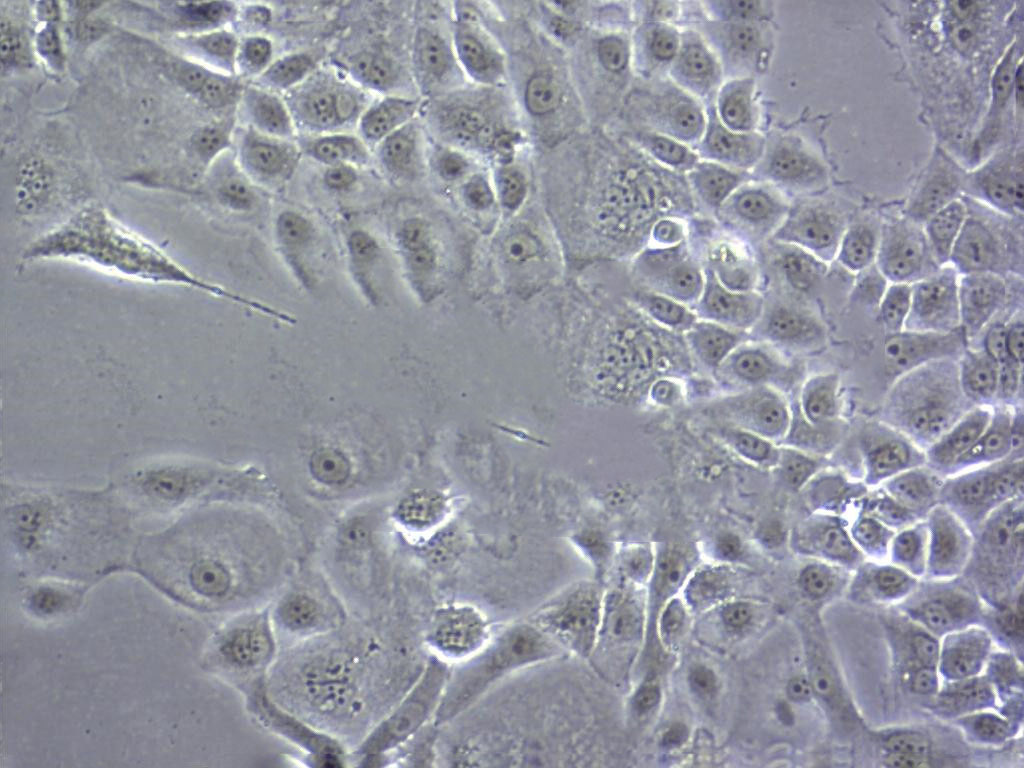 EFM-192C Cell|人乳腺癌细胞