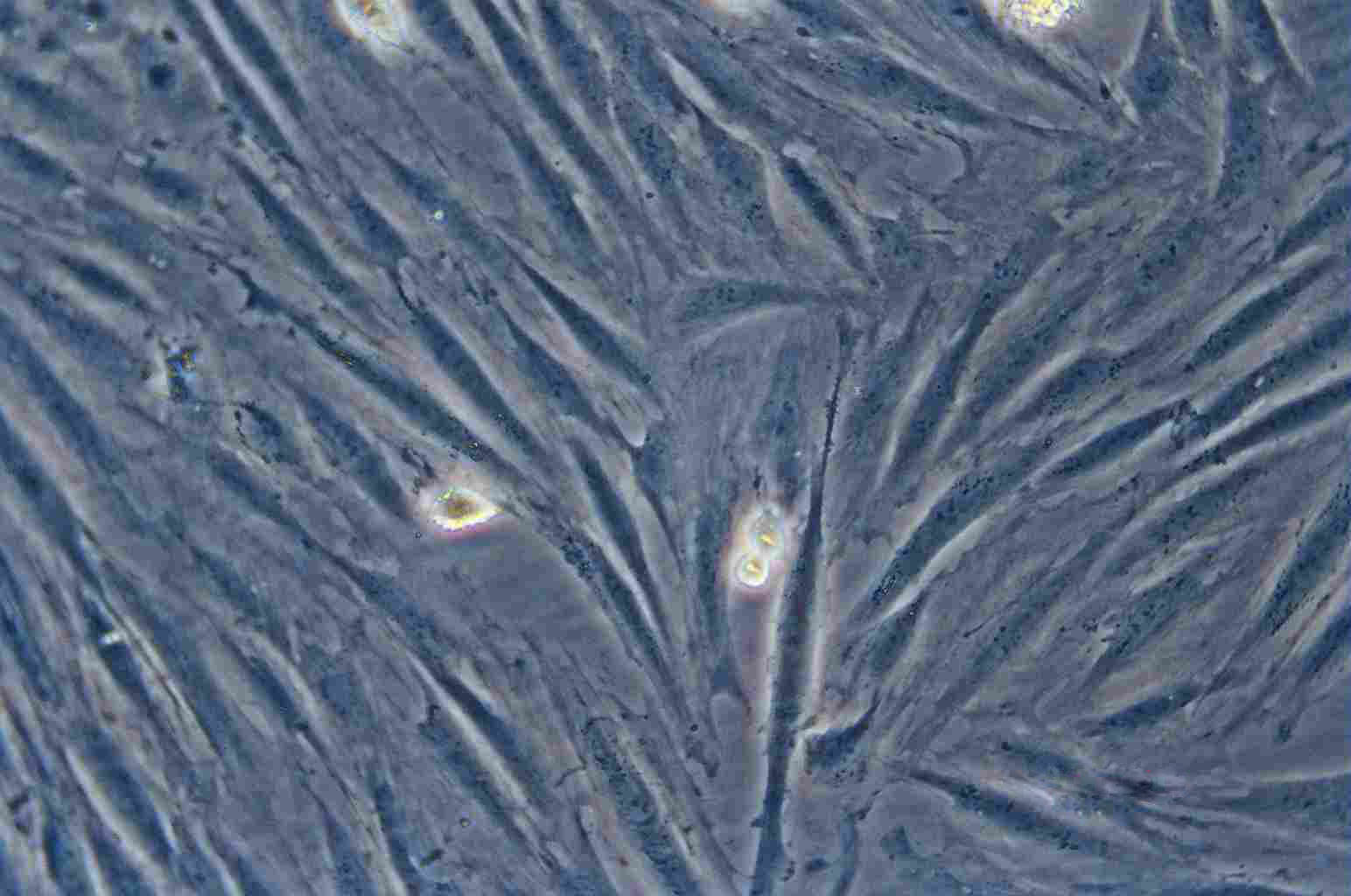 WI-38 Cell|人胚肺成纤维细胞