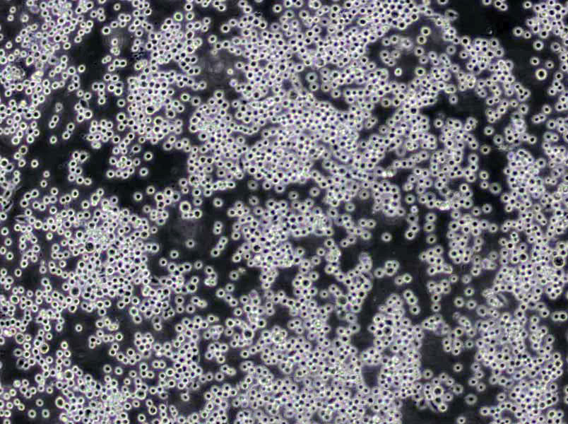 THP-1 Lymphoblast Cell|人单核细胞白血病传代细胞(有STR鉴定)