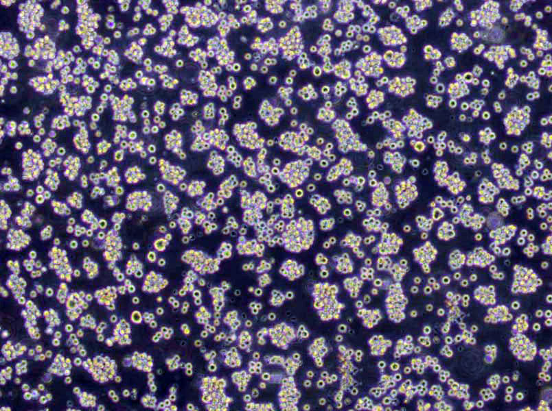 AML-193 Lymphoblast Cell|人急性单核细胞白血病单核传代细胞(有STR鉴定)