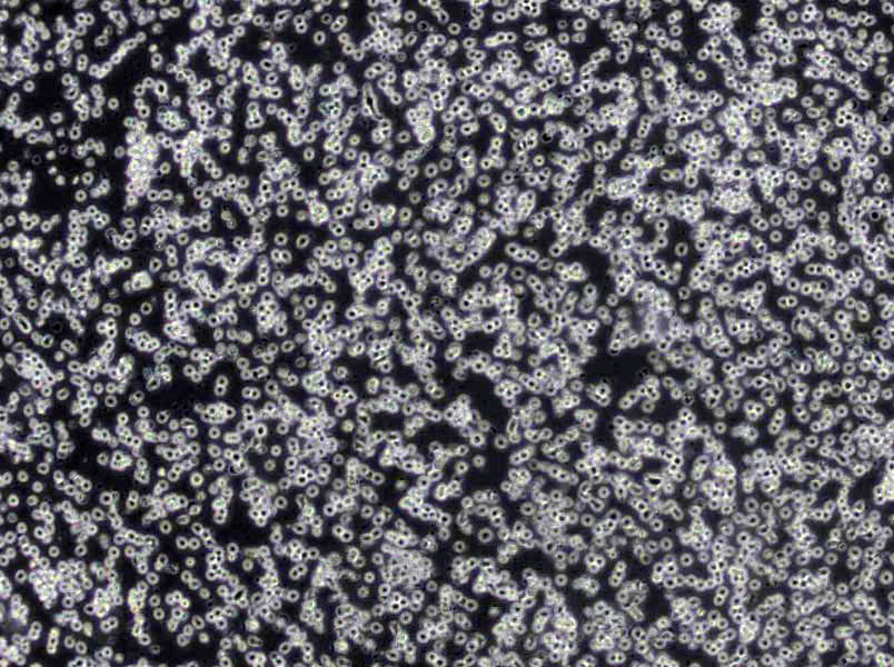 CEM/C1 Lymphoblast Cell|人急性淋巴细胞白血病传代细胞(有STR鉴定)