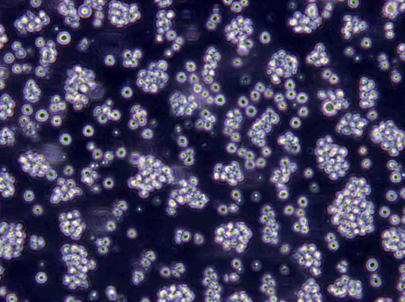 HDLM-2 Lymphoblast Cell|人霍奇金淋巴瘤传代细胞(有STR鉴定)