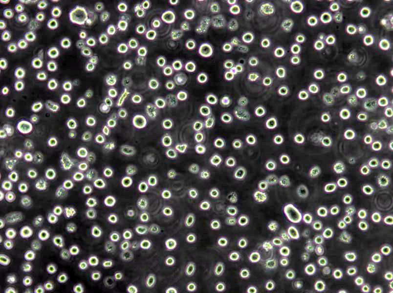 OCI-Ly8 Lymphoblast Cell|人弥漫大B淋巴瘤传代细胞(有STR鉴定)