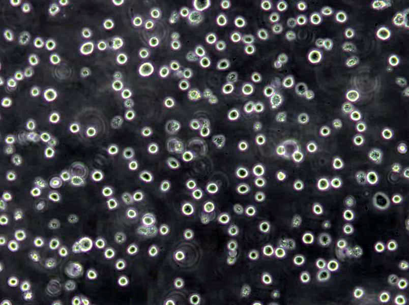 CEM-T4 Lymphoblast Cell|人急性T淋巴细胞白血病传代细胞(有STR鉴定)