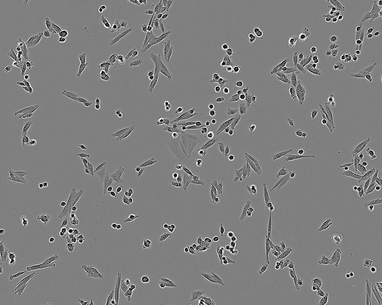 HuLEC-5a Epithelial Cell|人肺微血管内皮传代细胞(有STR鉴定)