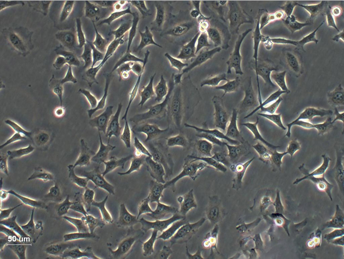 HCC1599 Epithelial Cell|人乳腺导管癌传代细胞(有STR鉴定)