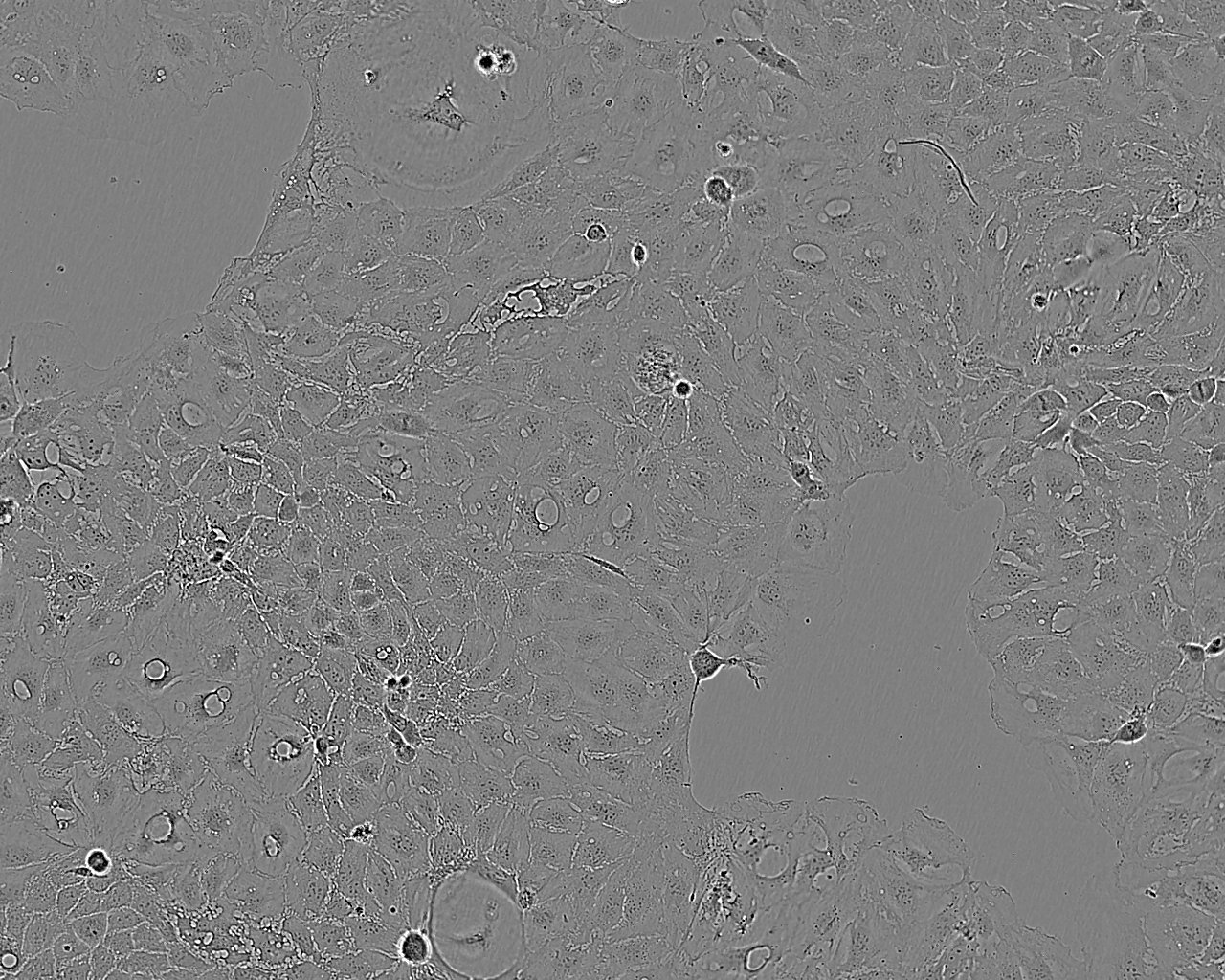 SW403 Epithelial Cell|人结肠腺癌传代细胞(有STR鉴定)