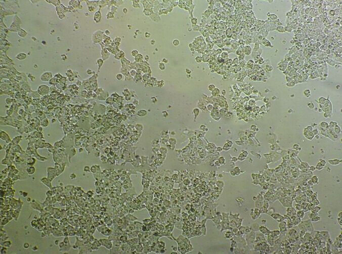 NCI-H2196 Epithelial Cell|人小细胞肺癌传代细胞(有STR鉴定)