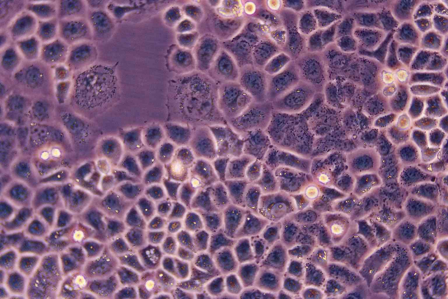 Capan-2 Epithelial Cell|人胰腺癌传代细胞(有STR鉴定)