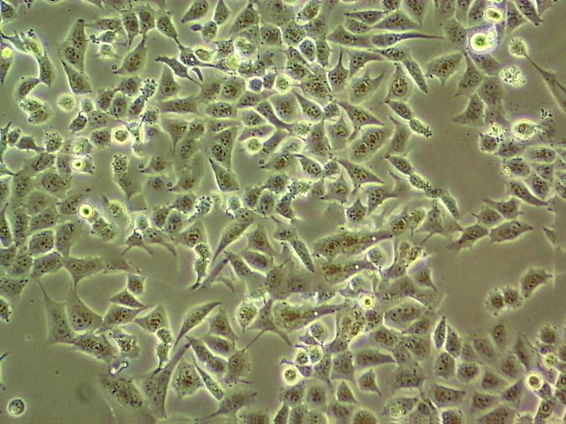 MIA PaCa-2 Epithelial Cell|人胰腺导管癌传代细胞(有STR鉴定)