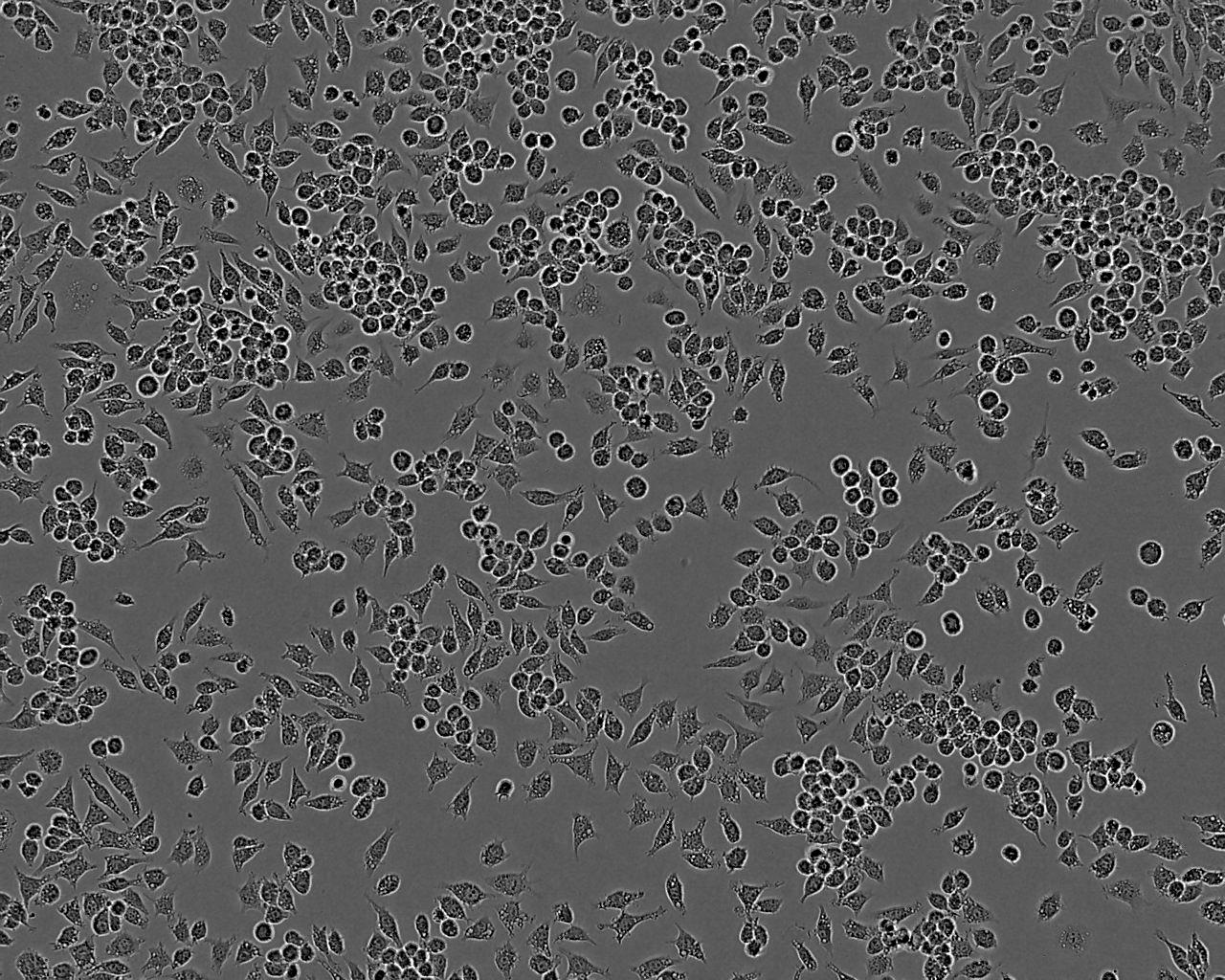 HPDE6c7 Epithelial Cell|人正常胰腺导管上皮传代细胞(有STR鉴定)