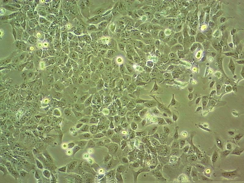 LP-1 Epithelial Cell|人多发性骨髓瘤白传代细胞(有STR鉴定)