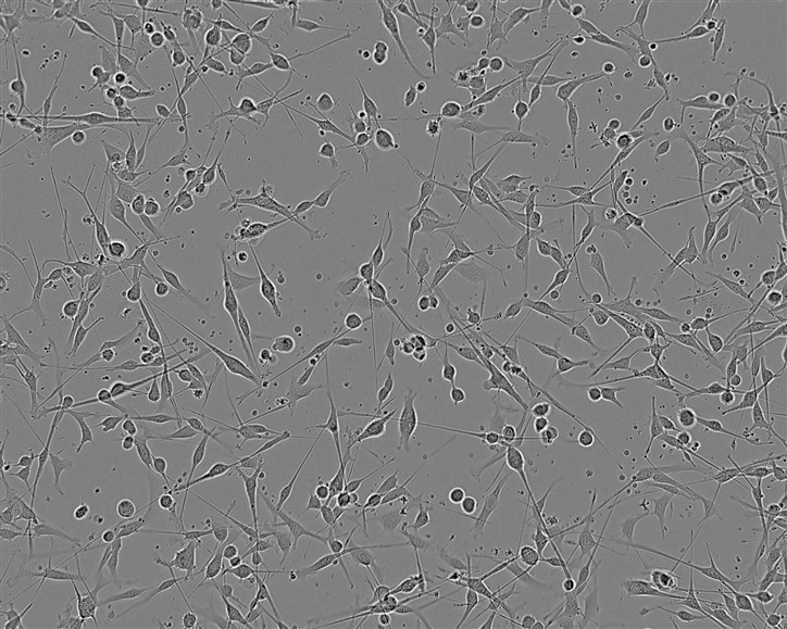 FOX-NY Epithelial Cell|小鼠骨髓瘤传代细胞(有STR鉴定)