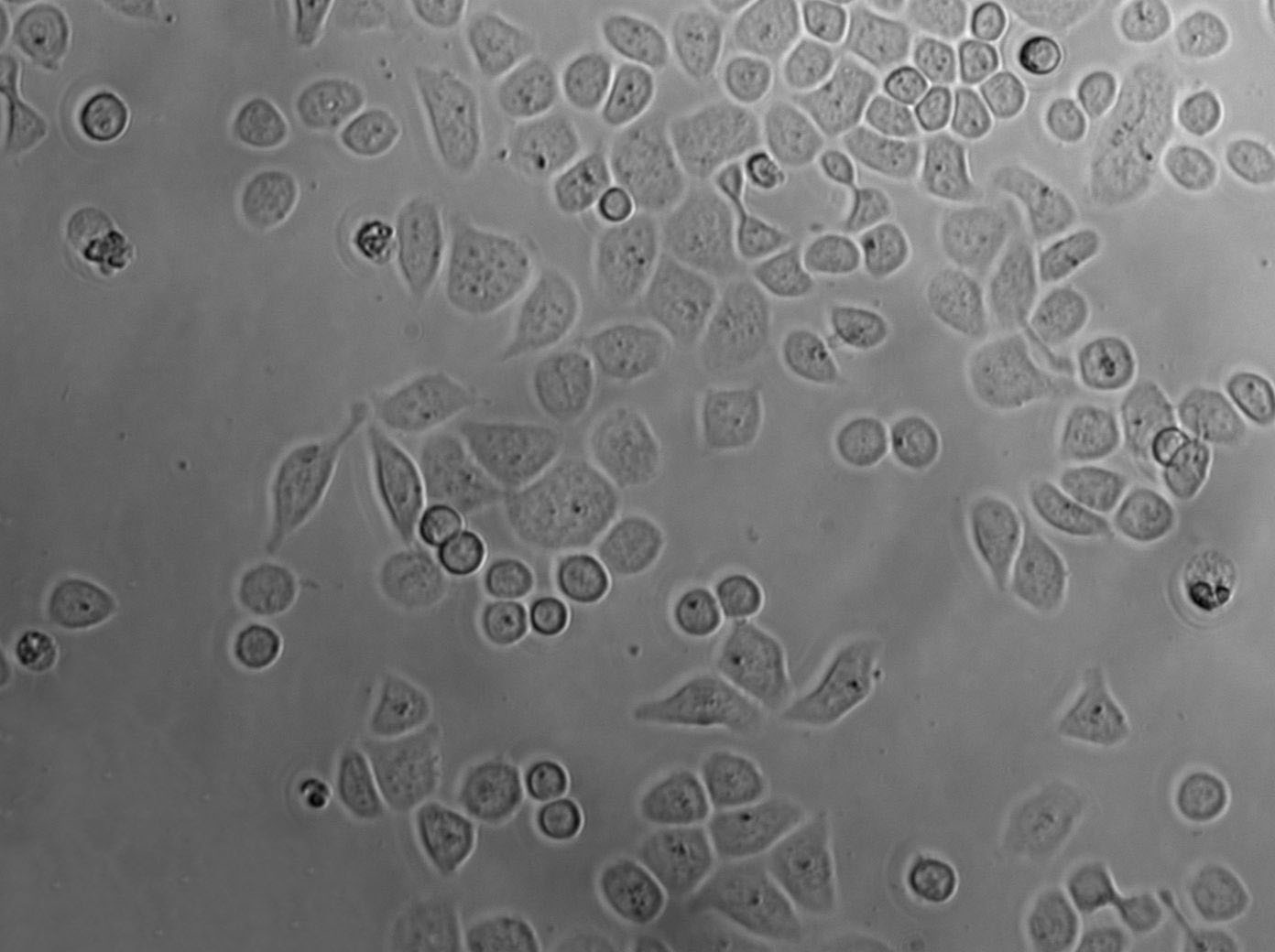 UM-UC-1 Epithelial Cell|人膀胱移行癌传代细胞(有STR鉴定)