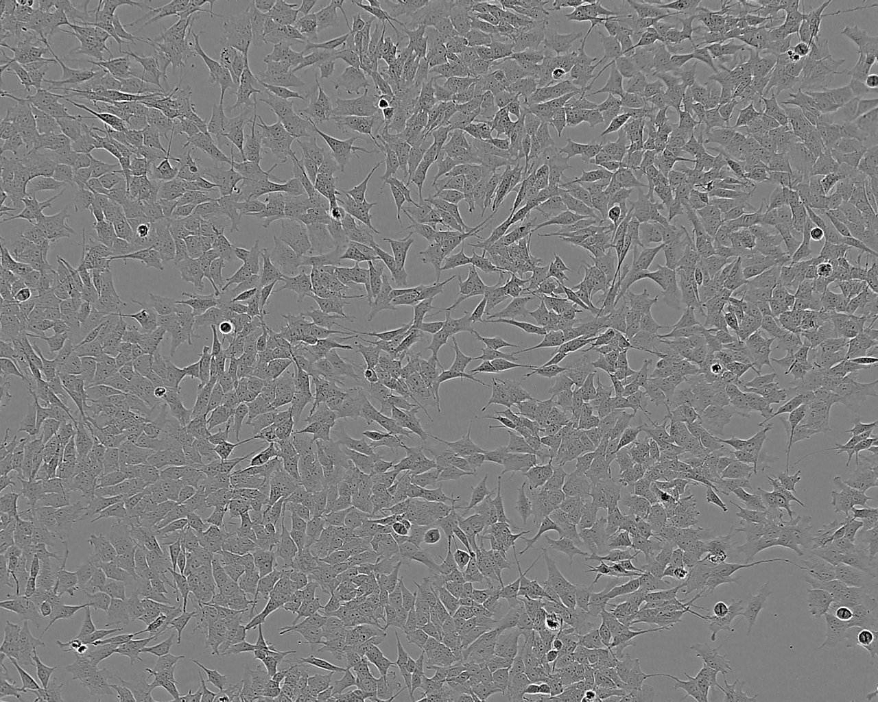 U-118MG Epithelial Cell|人脑星形胶质母传代细胞(有STR鉴定)