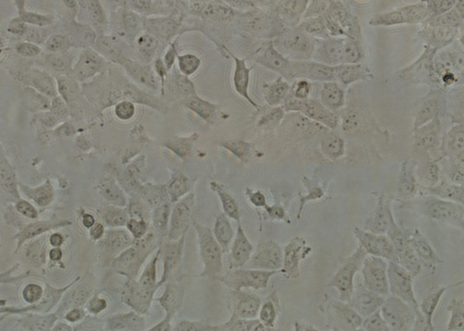 OVCAR-4 Epithelial Cell|人卵巢癌传代细胞(有STR鉴定)