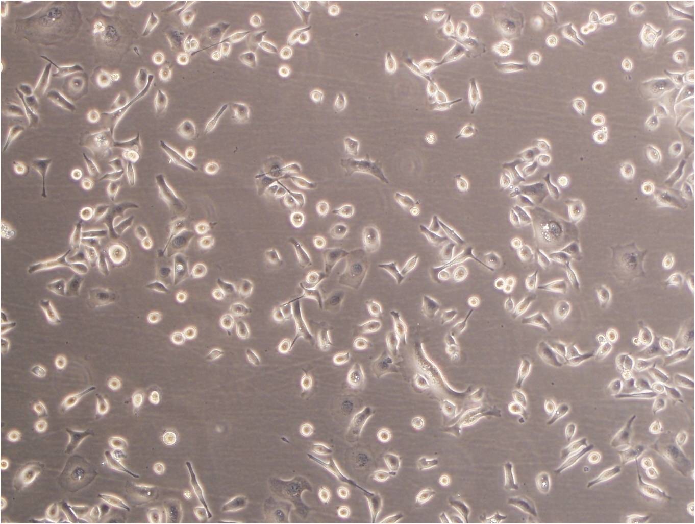 NCI-H1672 Epithelial Cell|人小细胞肺癌传代细胞(有STR鉴定)