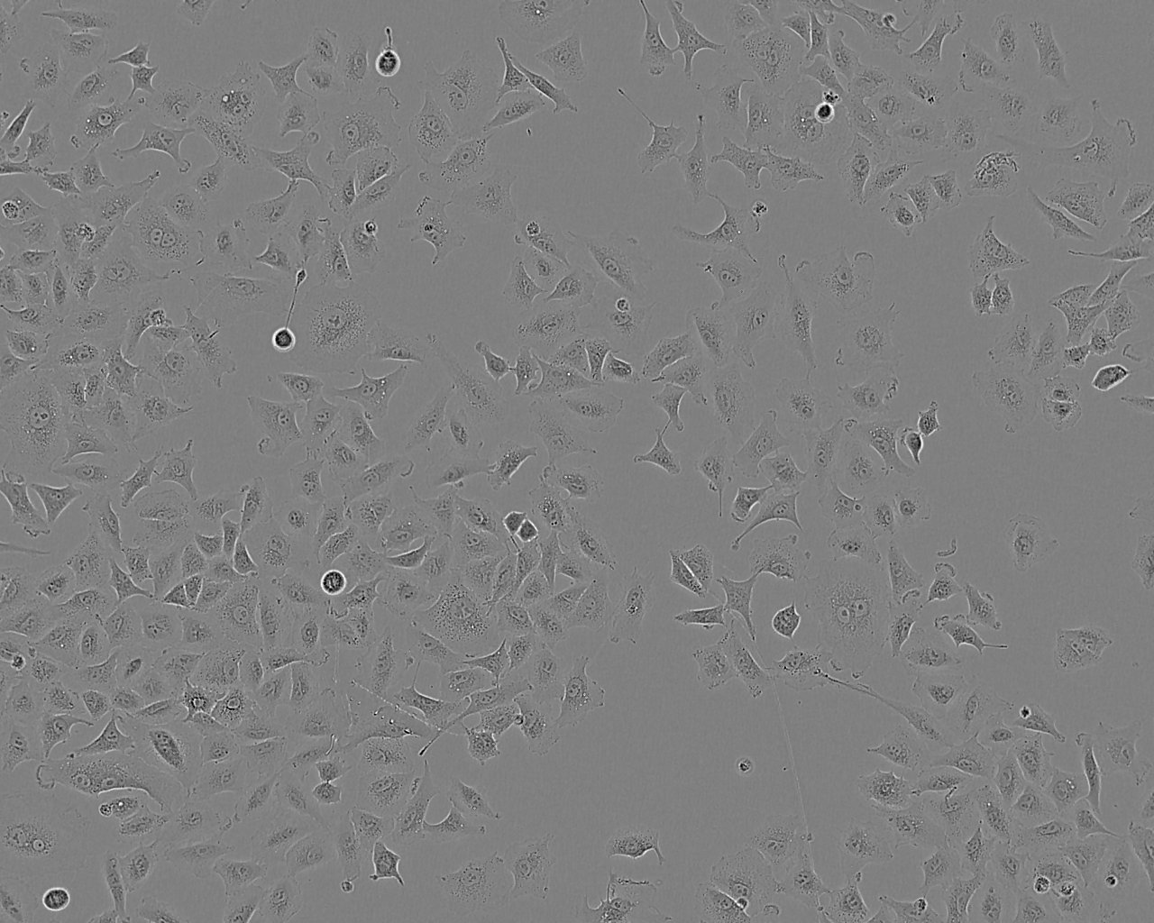 SNU-719 Epithelial Cell|人胃癌传代细胞(有STR鉴定)