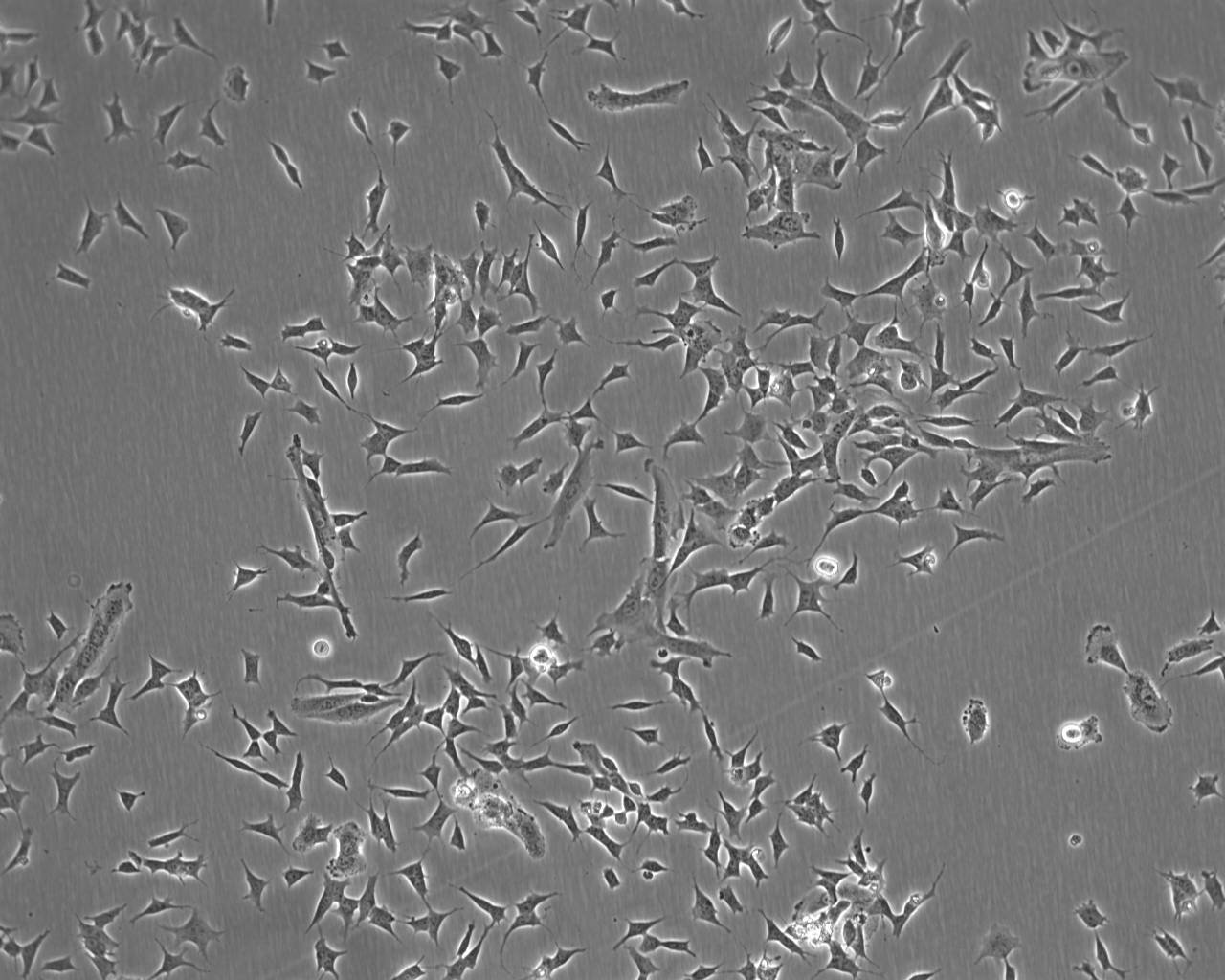 BEL-7404 Fresh Cells|人肝癌细胞(送STR基因图谱)