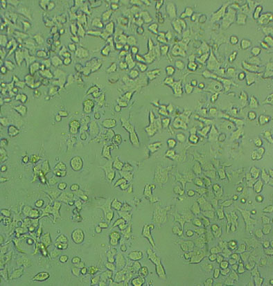 GES-1 Fresh Cells|人胃黏膜上皮细胞(送STR基因图谱)