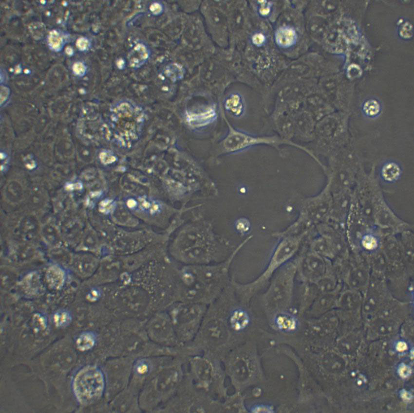 ChaGo-K-1 Fresh Cells|人肺支气管癌细胞(送STR基因图谱)