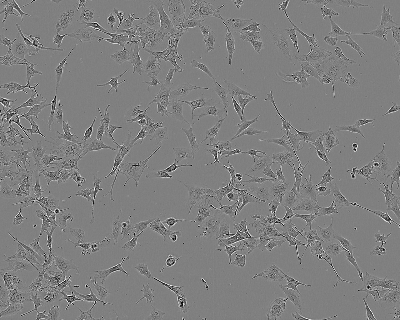 RPMI-7951 Fresh Cells|人恶性黑色素瘤细胞(送STR基因图谱)