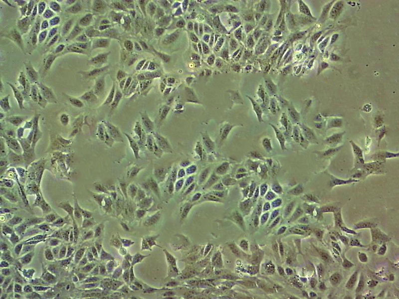 SK-MEL-1 Fresh Cells|人皮肤黑色素瘤细胞(送STR基因图谱)