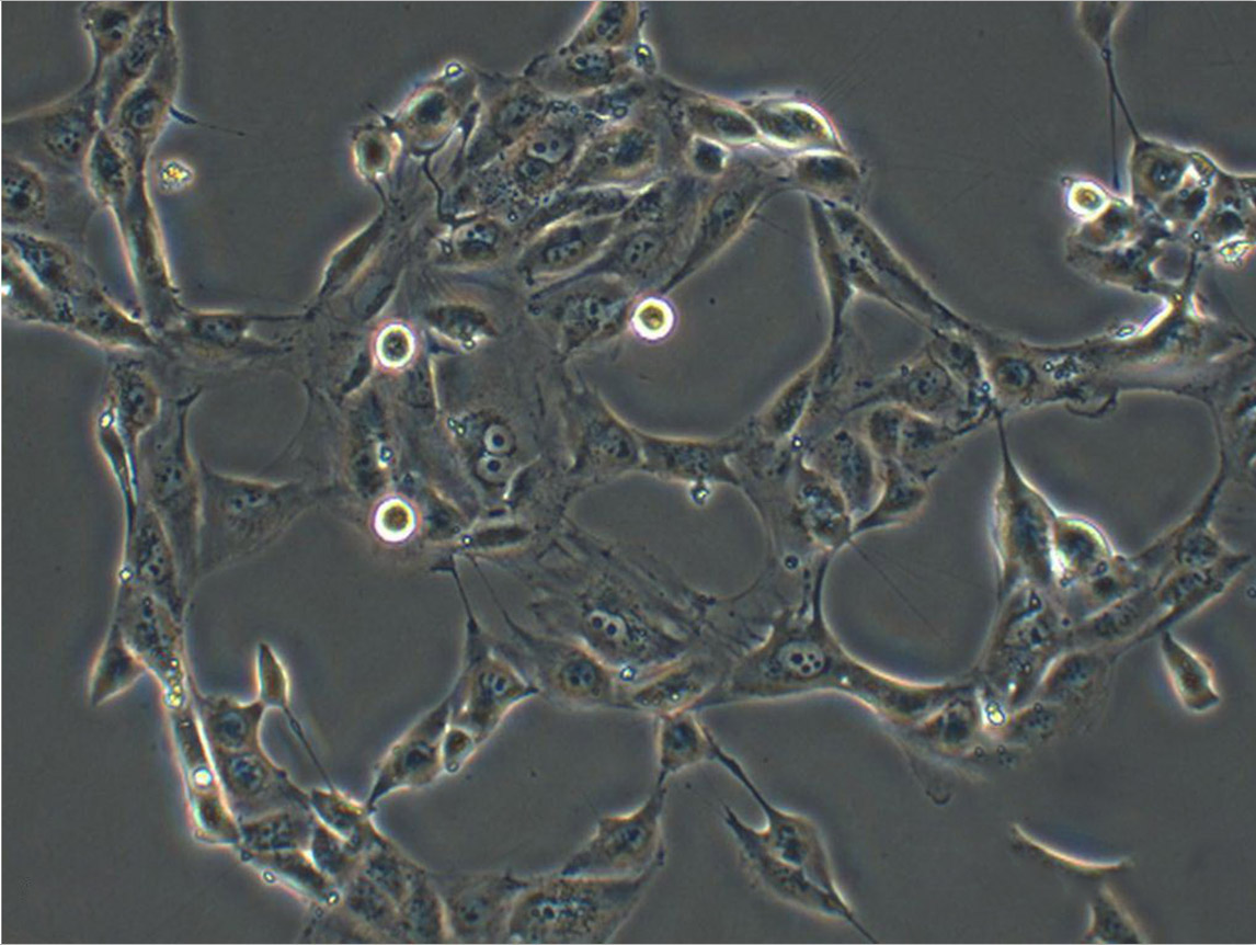 KYSE-270 Fresh Cells|人食道鳞状细胞癌细胞(送STR基因图谱)