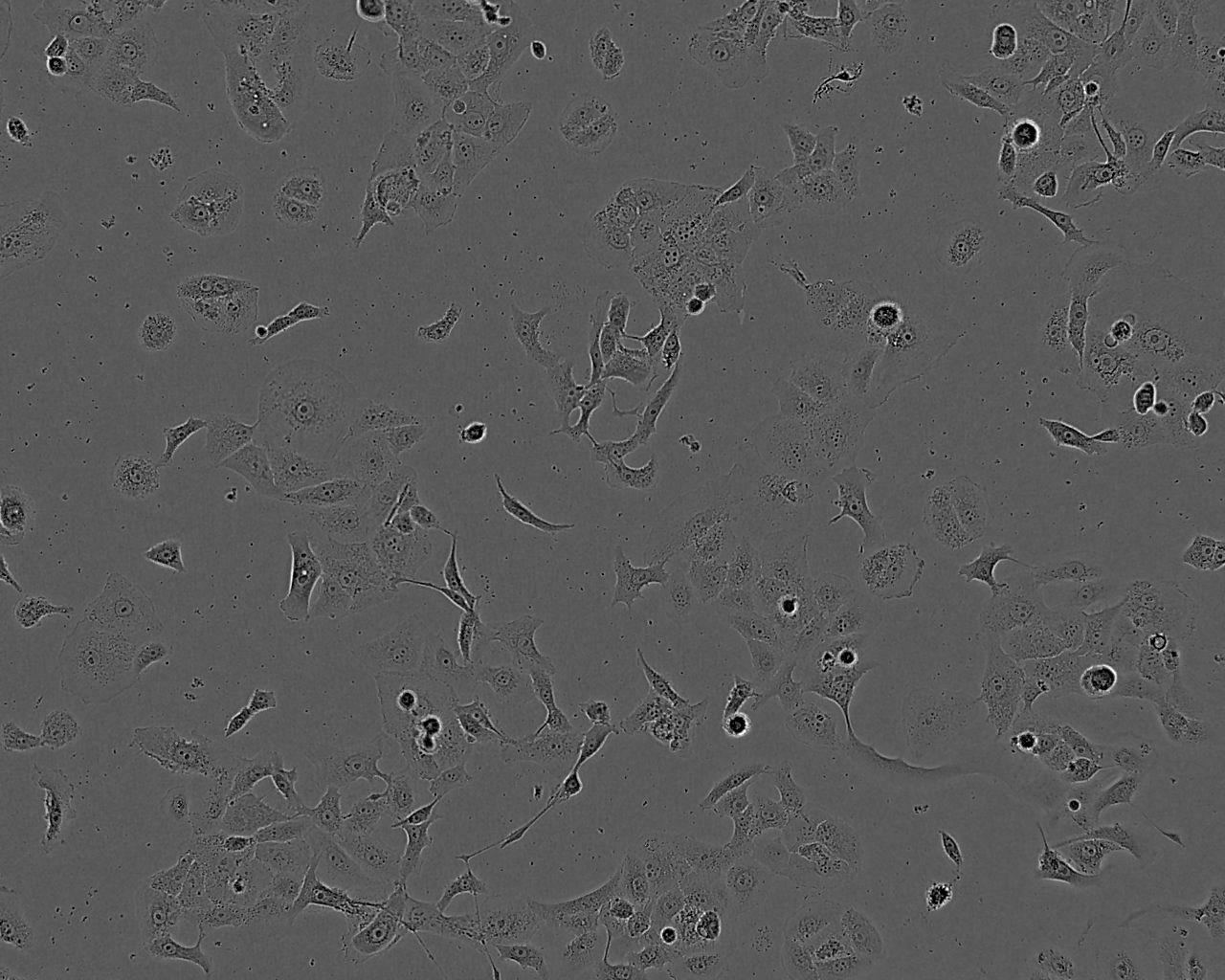 COLO 16 Fresh Cells|人皮肤鳞癌细胞(送STR基因图谱)