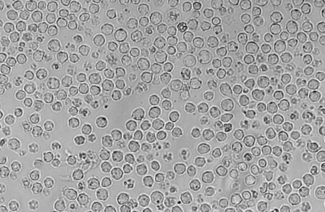 NCI-H1734 Cells|人非小细胞肺癌克隆细胞(包送STR鉴定报告)