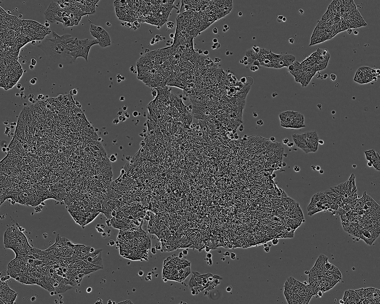 SCC7 Cells|小鼠鳞状细胞癌克隆细胞(包送STR鉴定报告)