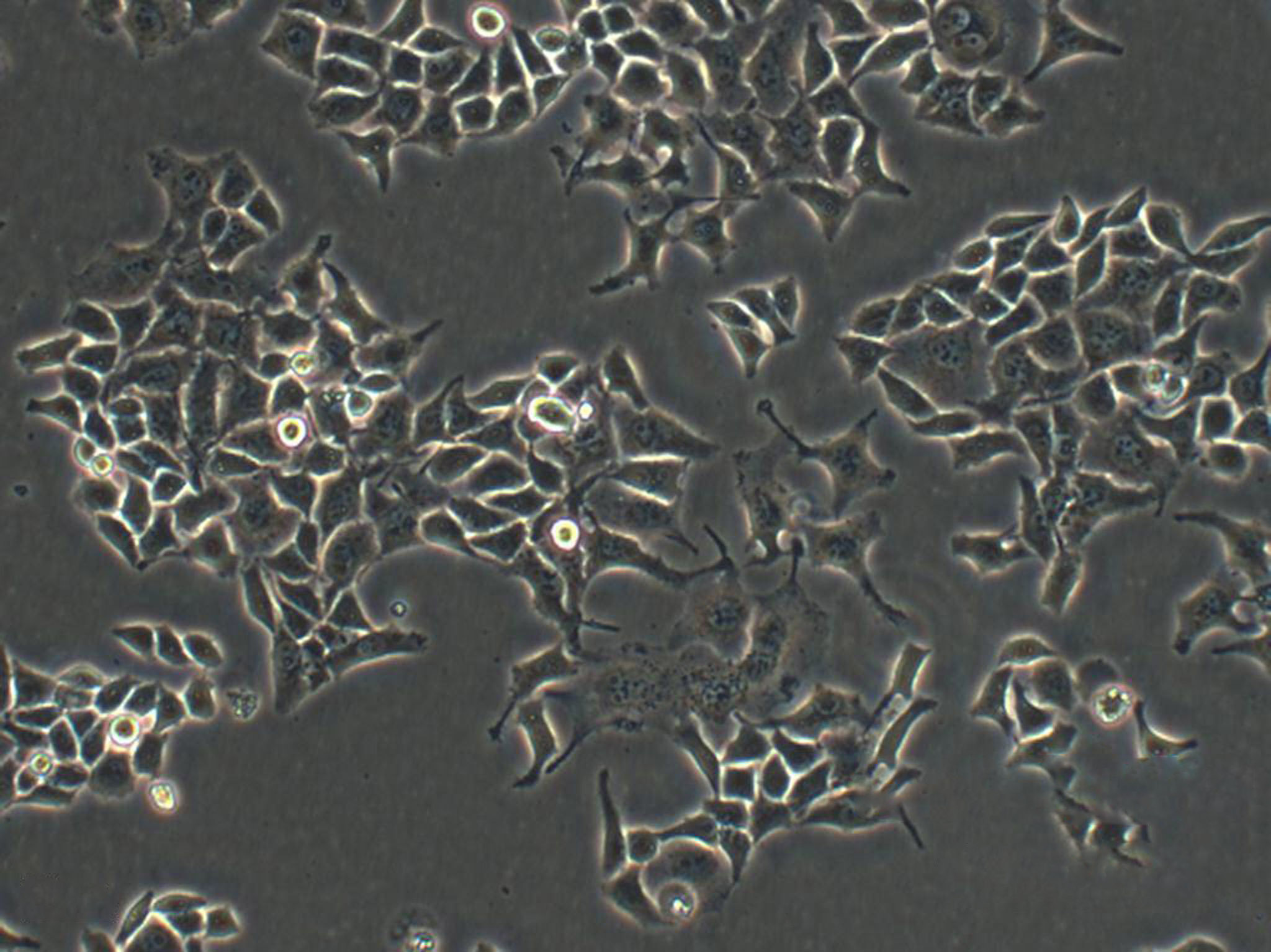 MDA-MB-468 Cells|人乳腺癌克隆细胞(包送STR鉴定报告)