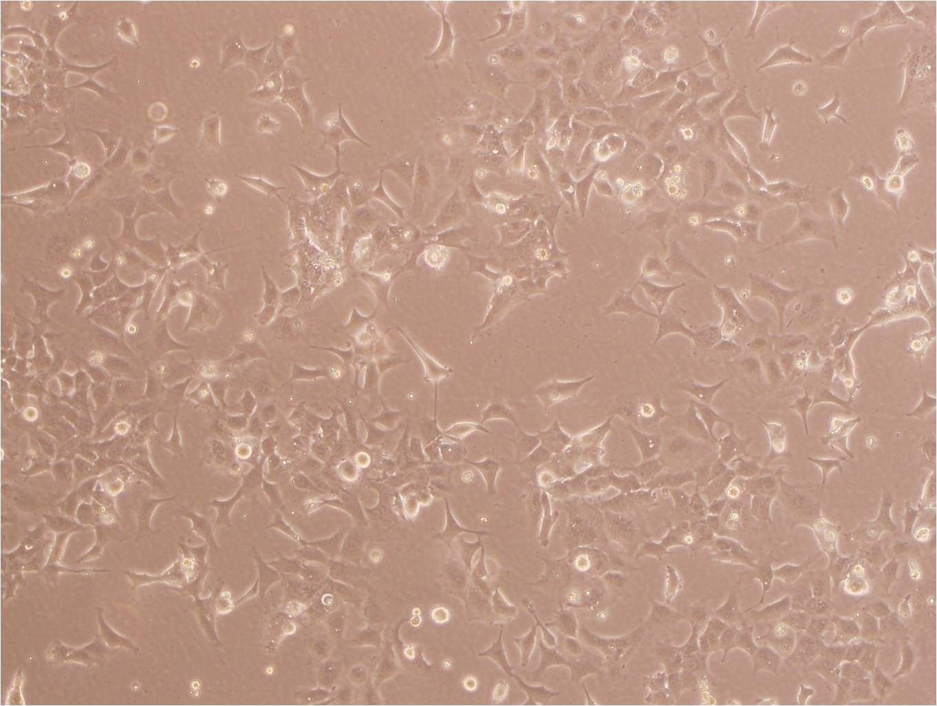 NCI-H1975 Cells|人肺腺癌克隆细胞(包送STR鉴定报告)