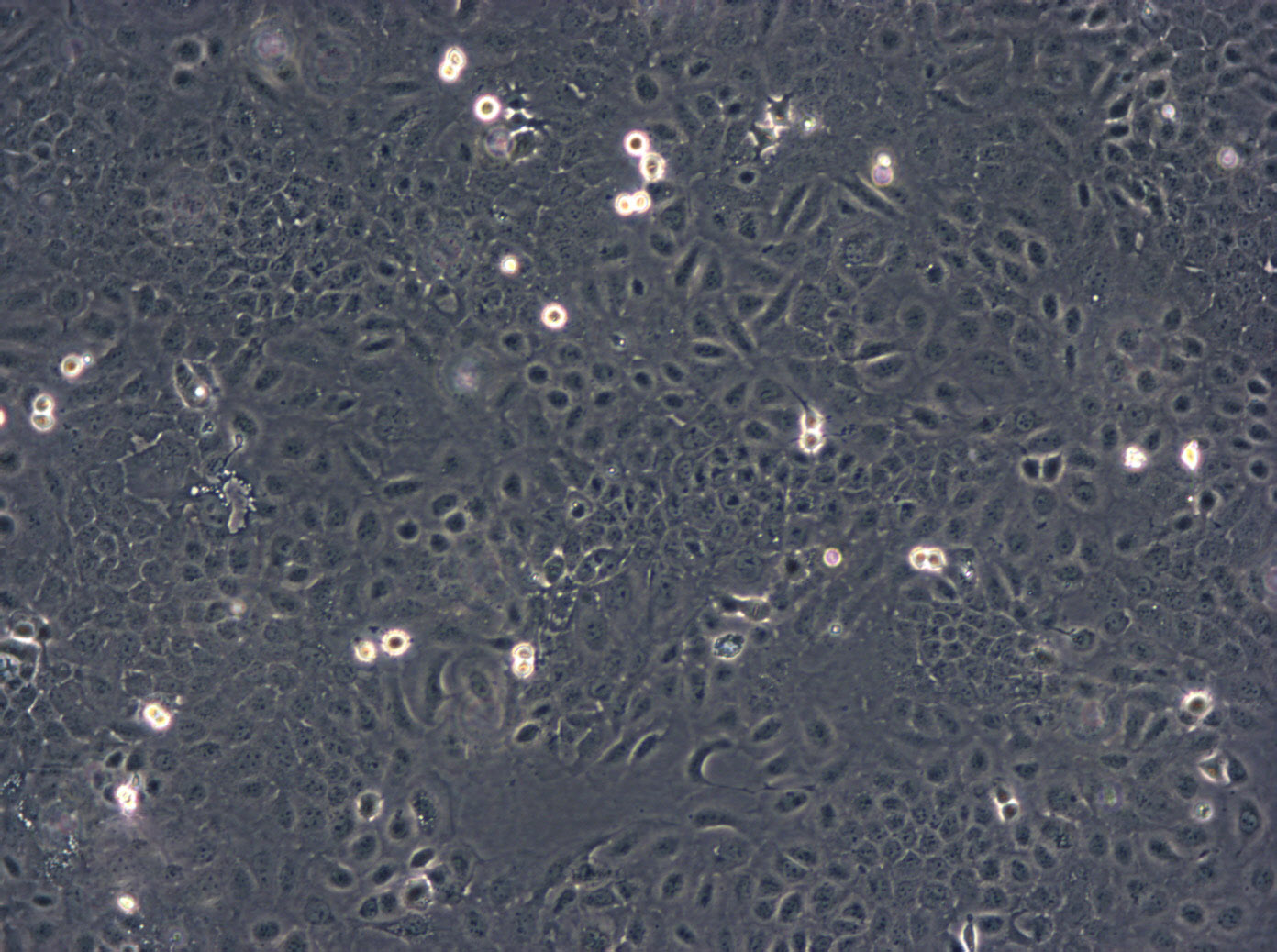 L-5178-Y-R Cells(赠送Str鉴定报告)|小鼠淋巴瘤细胞