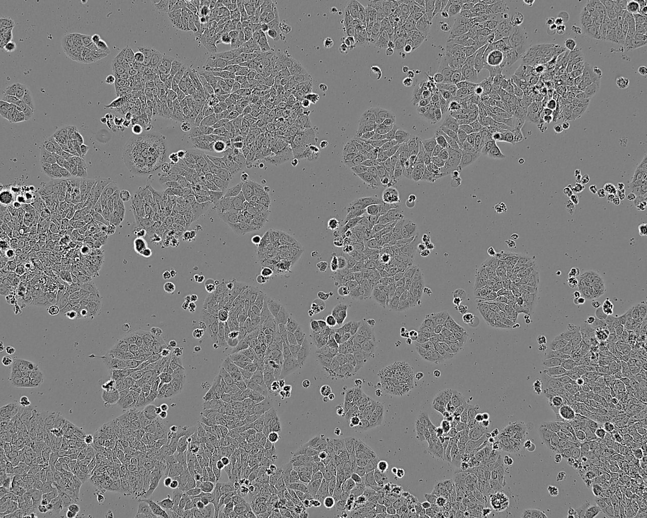 RPMI-6666 Cells(赠送Str鉴定报告)|人何杰金淋巴瘤细胞