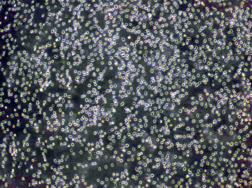 OCI-Ly1 Cells(赠送Str鉴定报告)|人弥漫大B淋巴瘤细胞