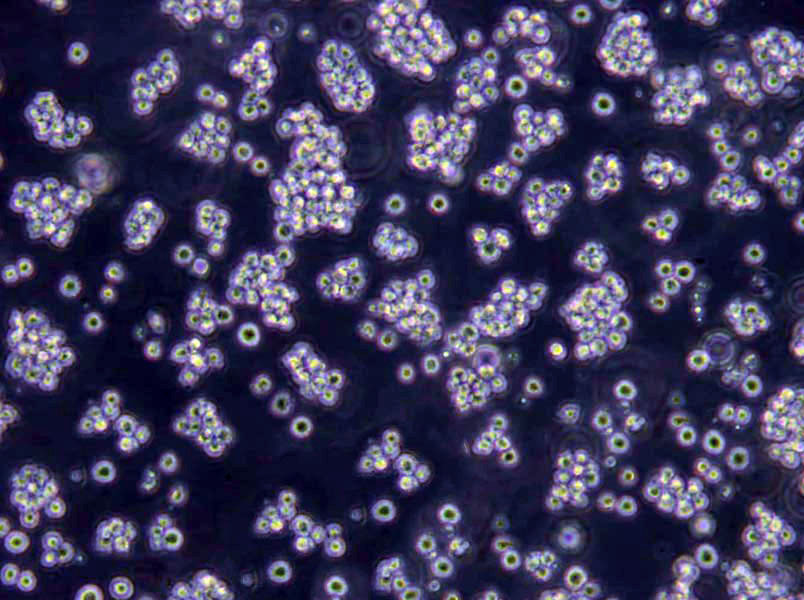 SU-DHL-10 Cells(赠送Str鉴定报告)|人B细胞淋巴瘤细胞