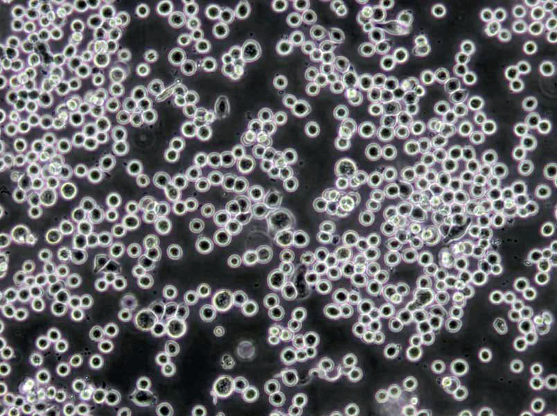 CCD-19Lu Cells(赠送Str鉴定报告)|人肺成纤维细胞