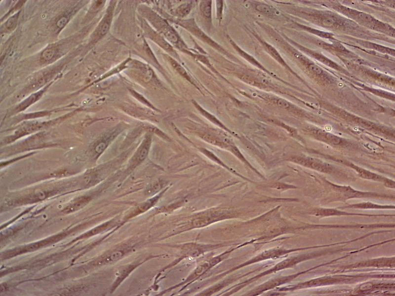 EJ-1 Cells(赠送Str鉴定报告)|人膀胱癌细胞