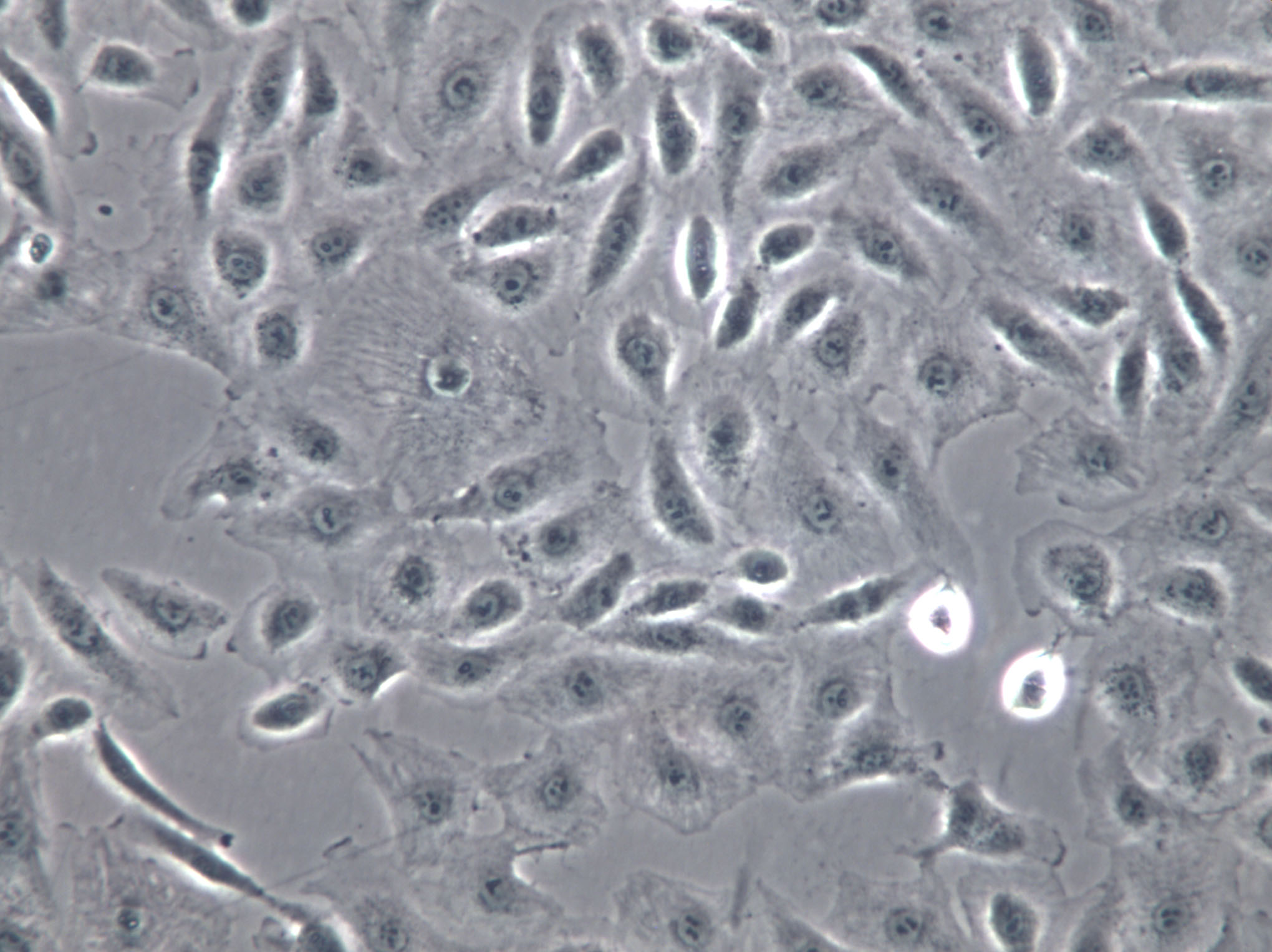 HCC1833 Cells(赠送Str鉴定报告)|人肺癌腺癌细胞