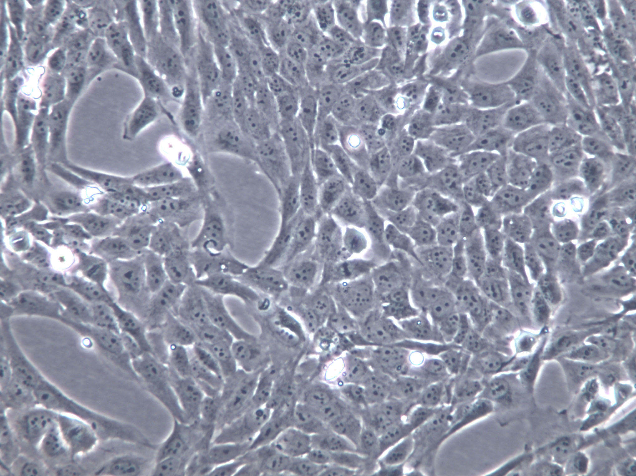 HARA-B Cells(赠送Str鉴定报告)|人肺癌鳞癌细胞