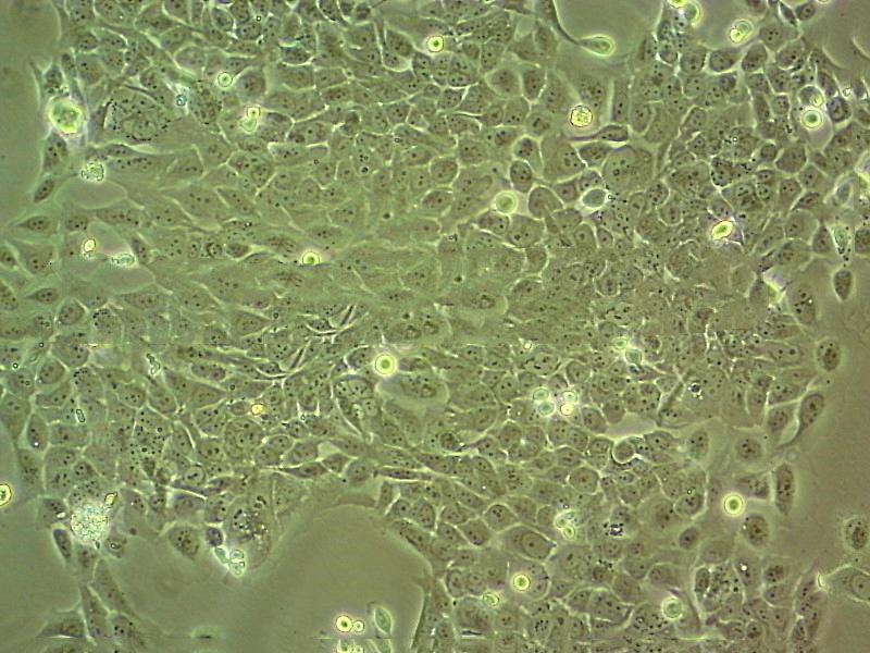 SW1222 Cells|人结肠癌克隆细胞(包送STR鉴定报告)